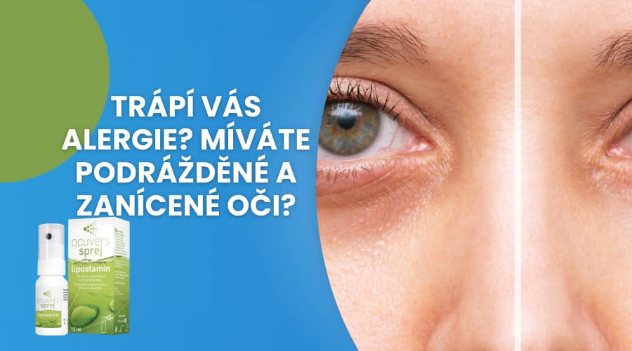 Trápi vás alergia? Mávate podráždené a zapálené oči?